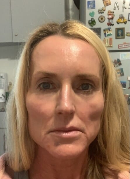 You can change your face shape naturally