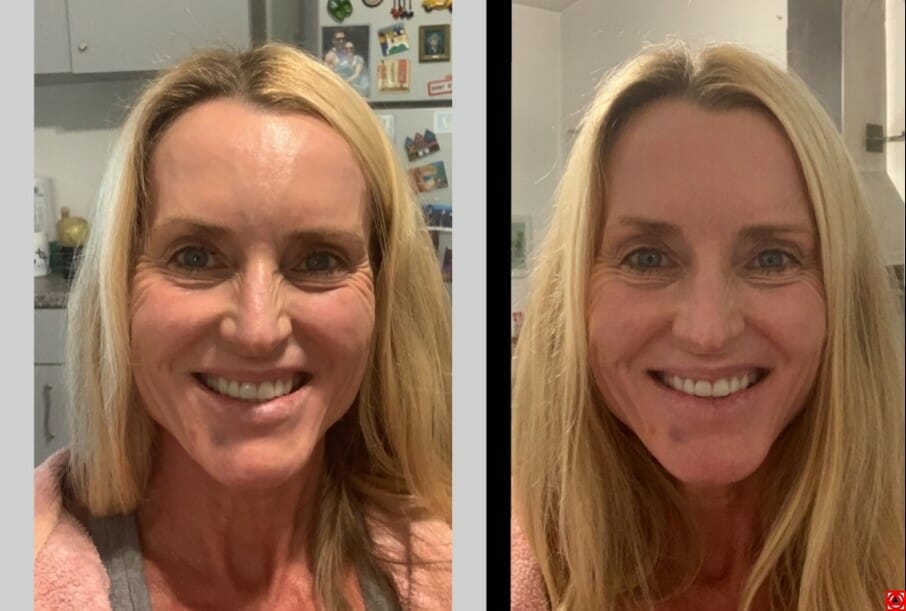 How to get a better smile naturally in 10 minutes?
